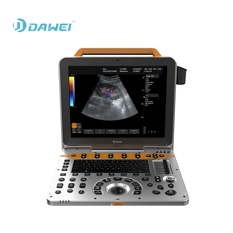 DAWEI P60 4D Portable Color Doppler Human Ultrasound Gynecology Cardiovascular Echo Machine Sale scanner with CE&ISO certificate