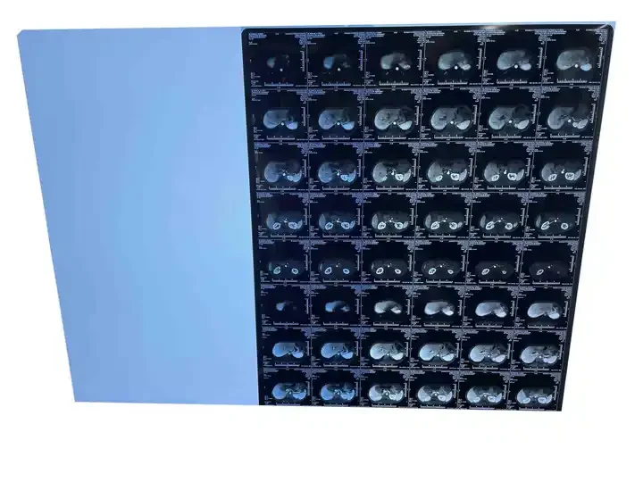 Medical Dry Film X-ray Film 210 Microns Inkjet Film Blue