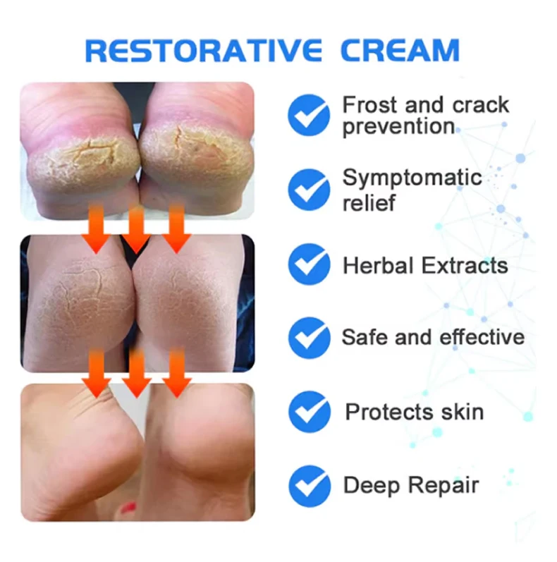 Dry Cracked Heel Callus Remover Heel Balm Skin Care Products Body Care Rejuvenating Set Moisturizing Foot Cream Balm