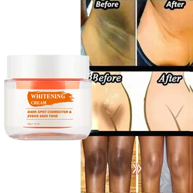 Отбеливающий крем для лица, 7 дней