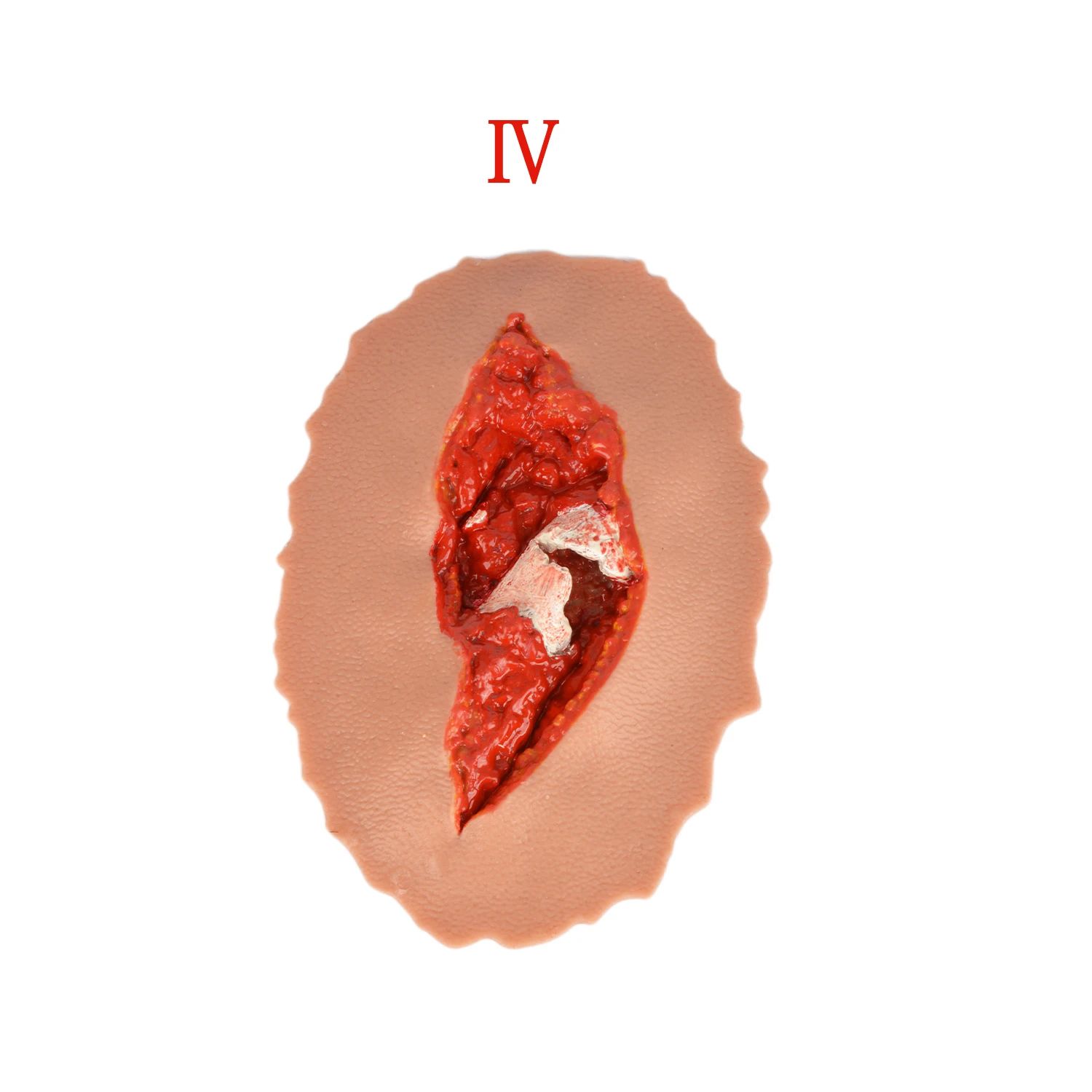 wearable open fracture trauma model for TCCC course EMT course first aid training Pre-hospital emergency care