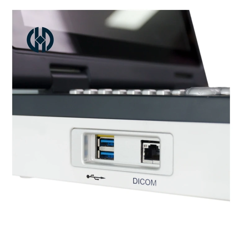 15 inch diagnostic ultrasound scanner ultrasound machine portable for ob echocardiogram musculoskeletal human medical