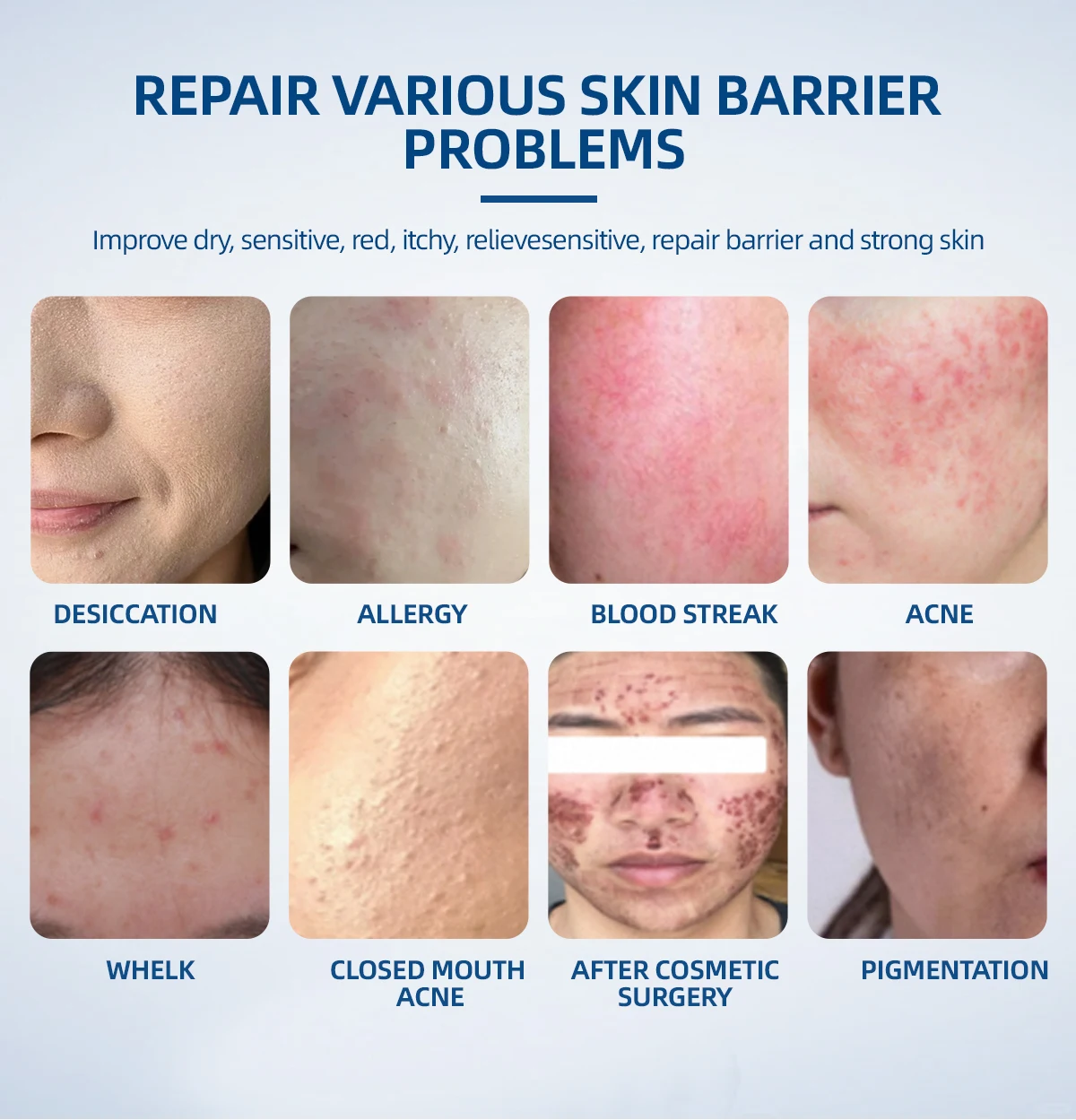 Chinese high quality medical beauty products cosmetic skin repair gel natural organic skin care ointment for sensitive skin