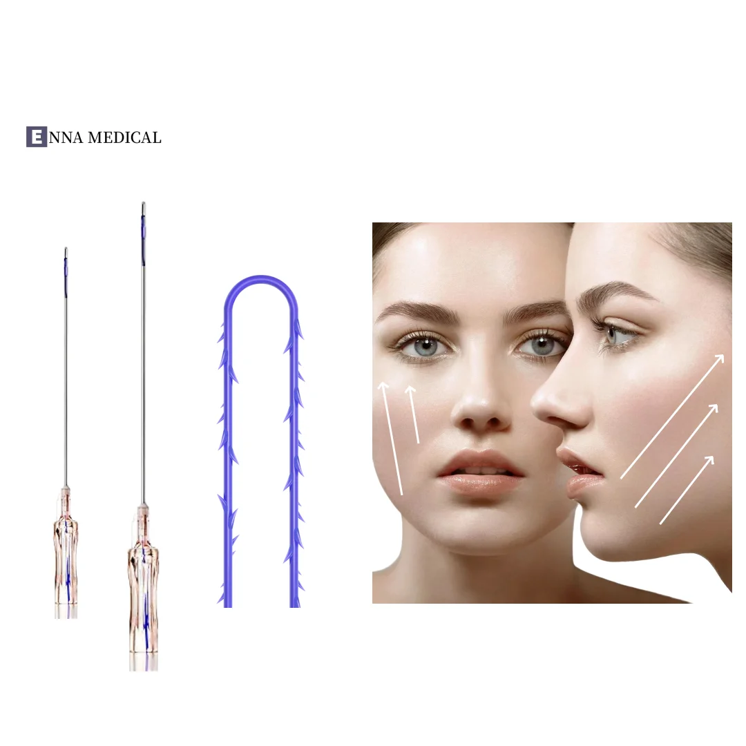 ENNA pdo cog derma v lifting thread 3d thread cog 4d 19g 21g 23g 3d 4d Pdo PCL Thread Face LIft Fishbone Cog