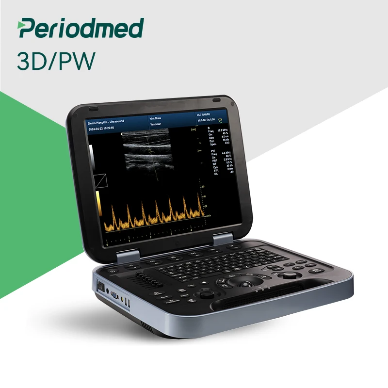 Periodmed Support OEM/ODM Medical Portable Ultrasound 3D Medical Portable Ultrasound Medical Equipment Ultrasound Machines