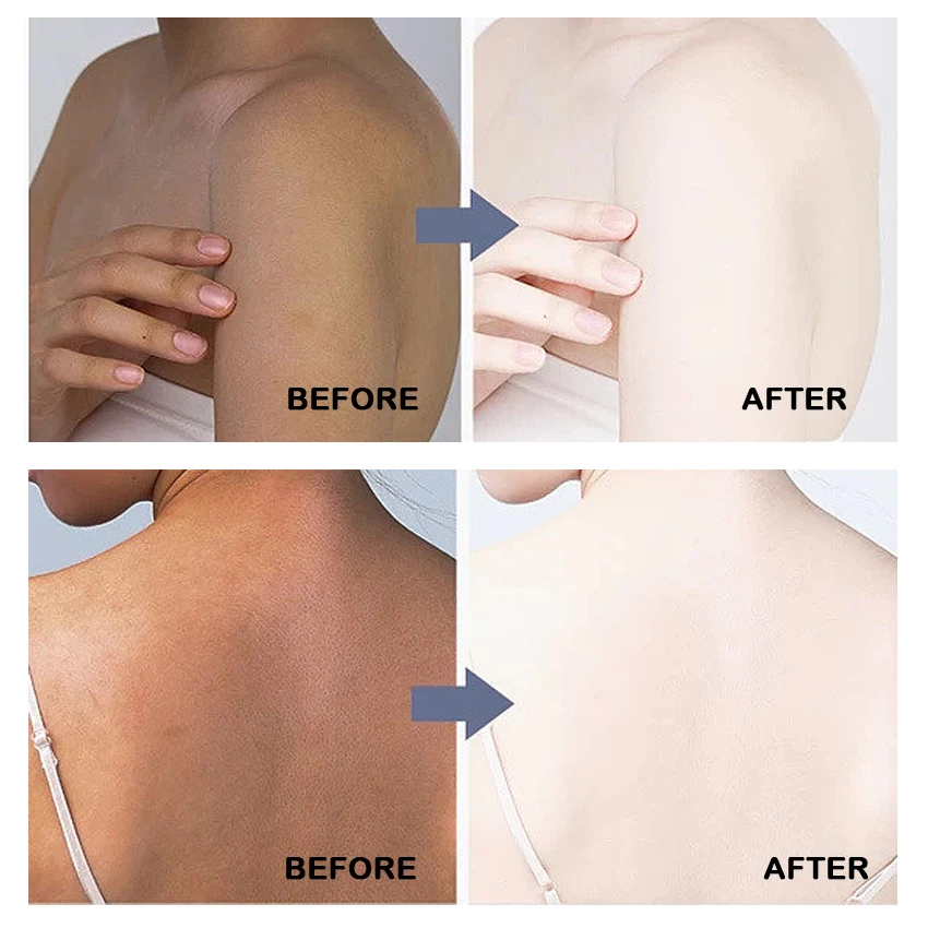 Private Label Dark Skin Strong Bleaching Cream Body Lotion Hydratante Organic Carrot Remove Pimples Lait De Corps Eclaircissant