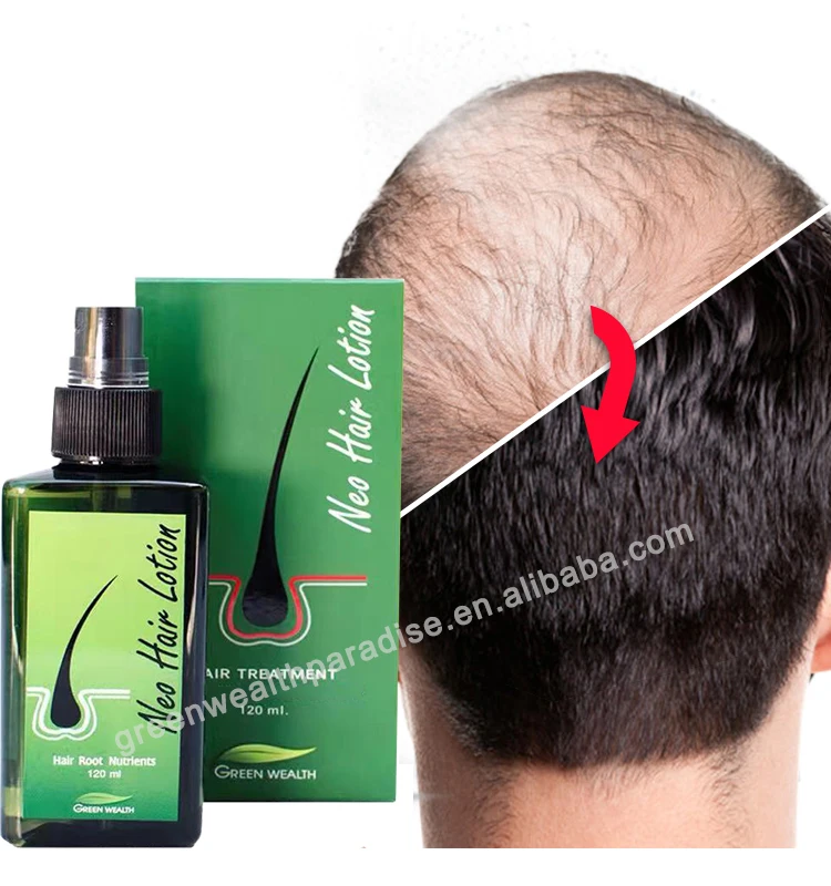Hot Sell 120ML Neo Hair Lotion Green Wealth Thailand fast growth hair oil for Men and Women