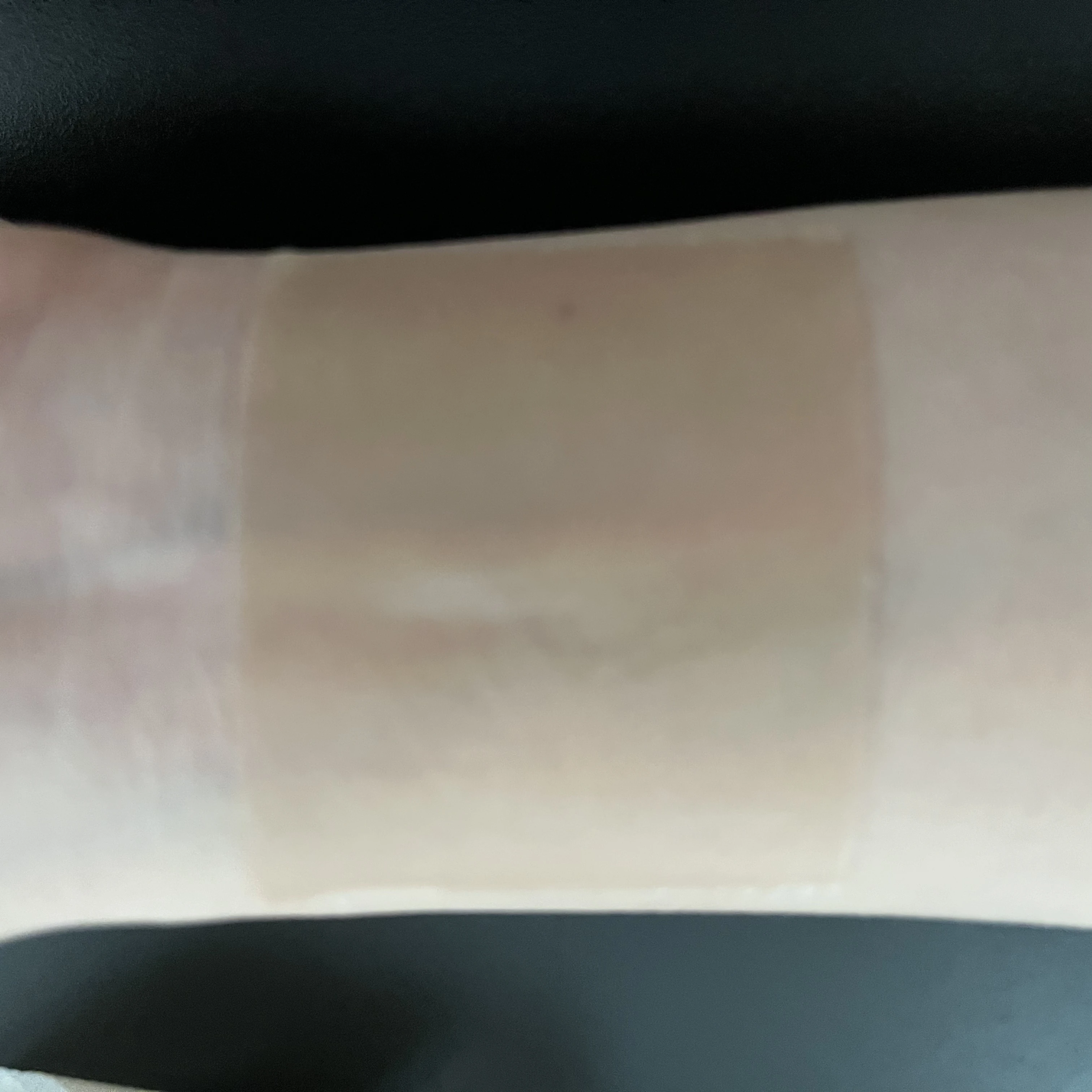 Hot Sale Skin Color Silicone Scar Patches for Medical Treatment Reduce Redness and Itching