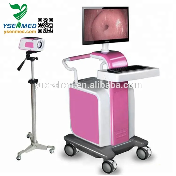 YSSW3303B High advantage colposcope trolley gynecology video colposcope