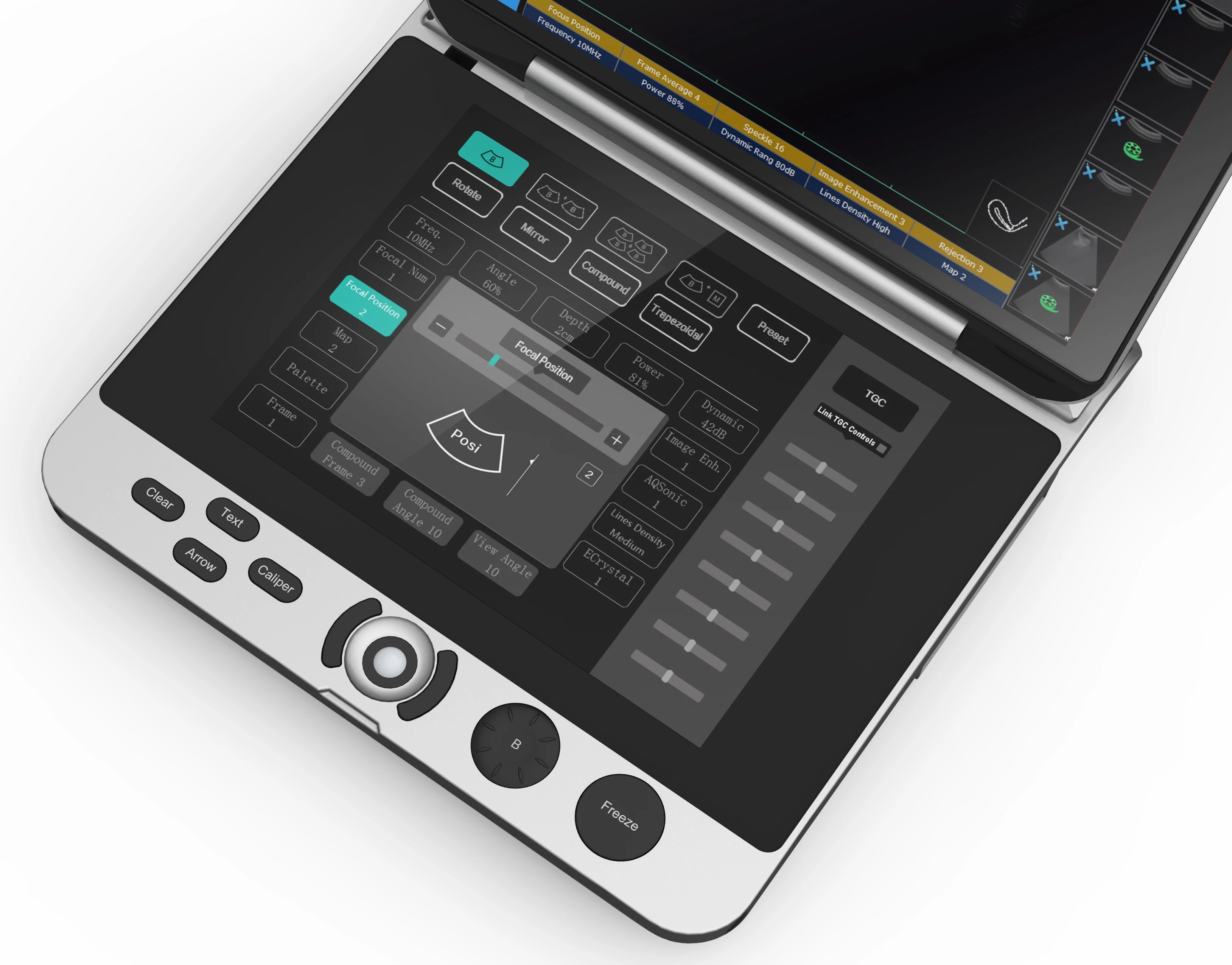 High resolution  laptop B/W ultrasound MSK  ultrasound scanner  laptop ultrasound machine