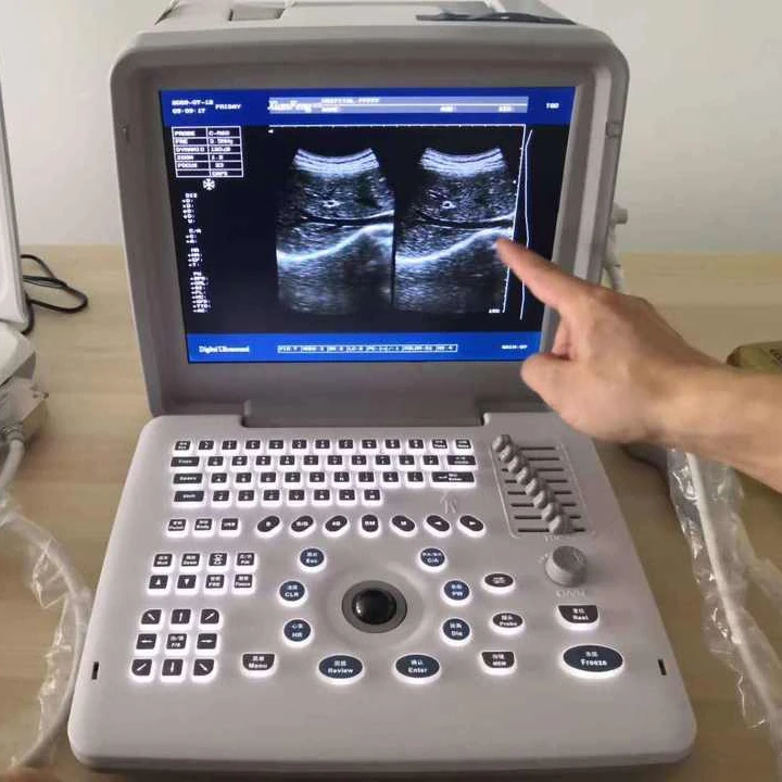 cheap medical B&w b ultrasound machine price with 3mhz probe