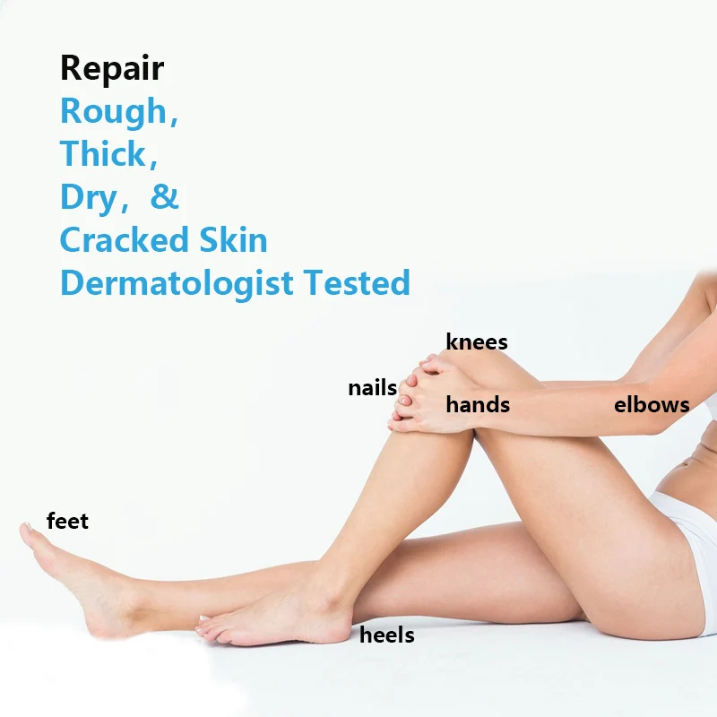 Urea 40% Plus 2% Salicylic Acid  Crack Foot Cream Heel Cracked Repair Remove Dead Skin Hand Feet Care Custom Moisturizing Cream