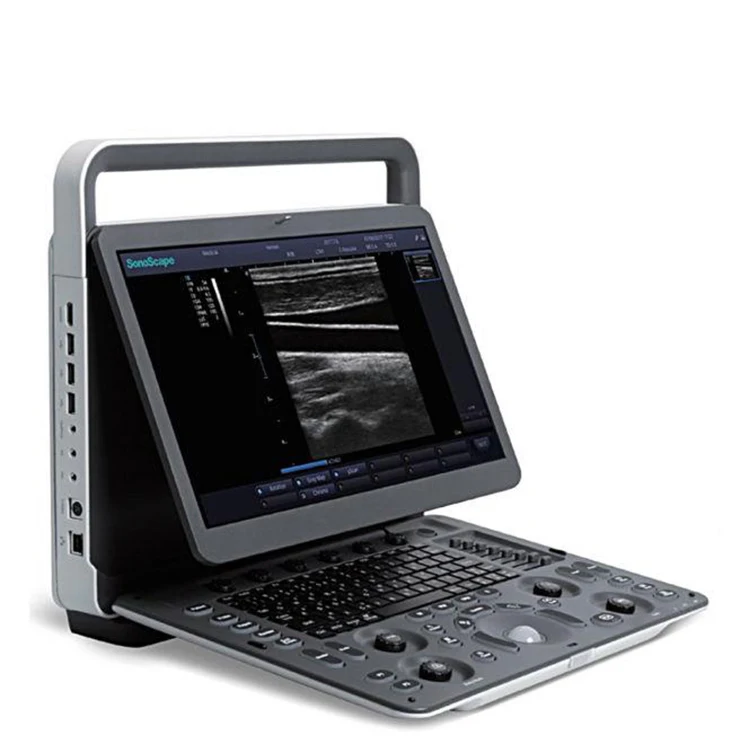 SonoScape E3V Color Doppler Veterinary Diagnostic Ultrasound System sonoscape ultrasound