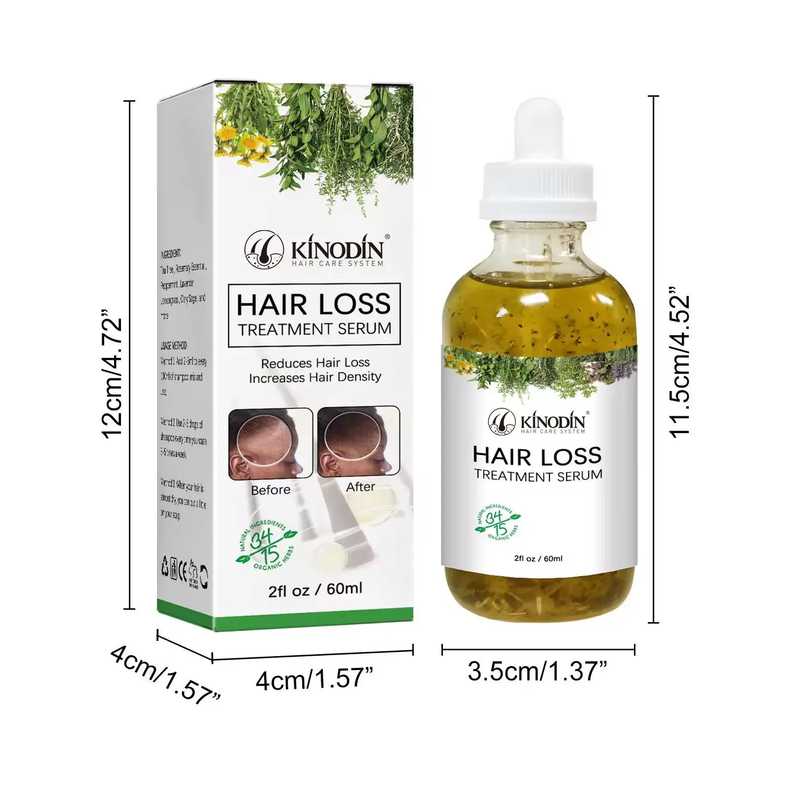 African All Natural Hair Treatment Products Miracle Rosemary Mint Hair Growth Oil Serum for African Hair Natural Babies