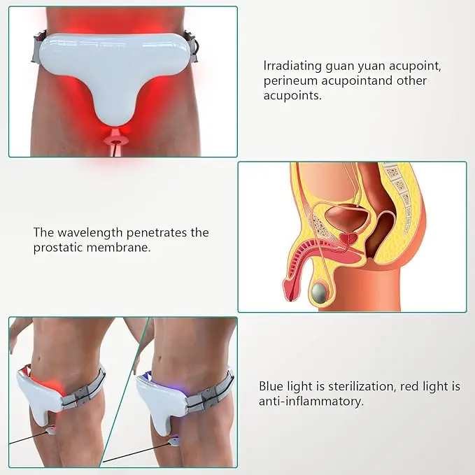 prostatitis treatment deep tissue laser therapy machine prostate laser therapy device physiotherapy equipment