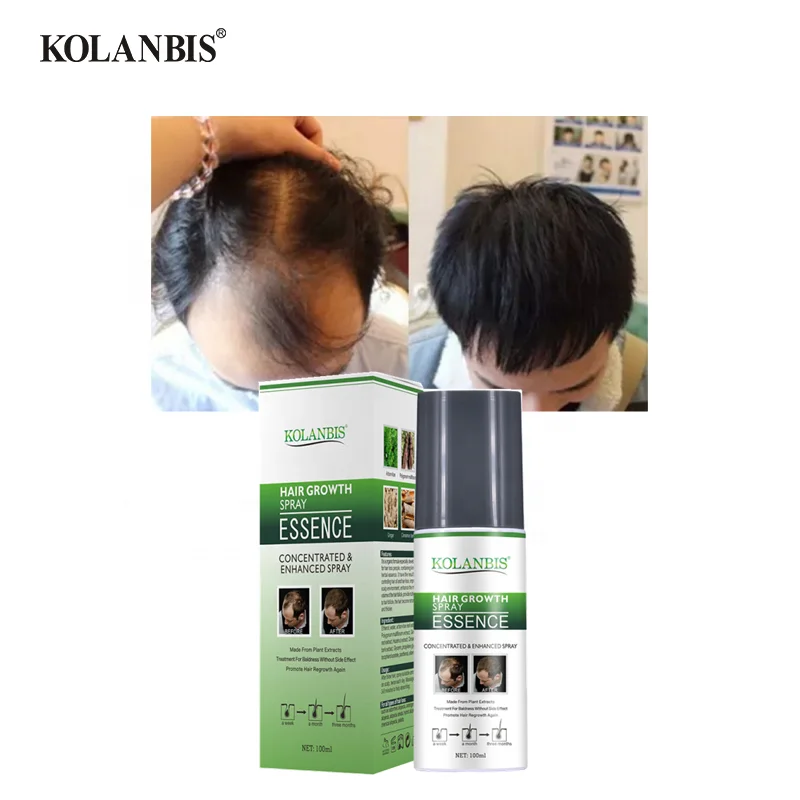 KOLANBIS Wholesale Best Selling Pure Hair Instant Growth Oil Spray Products For Mens Full Hair Treatments