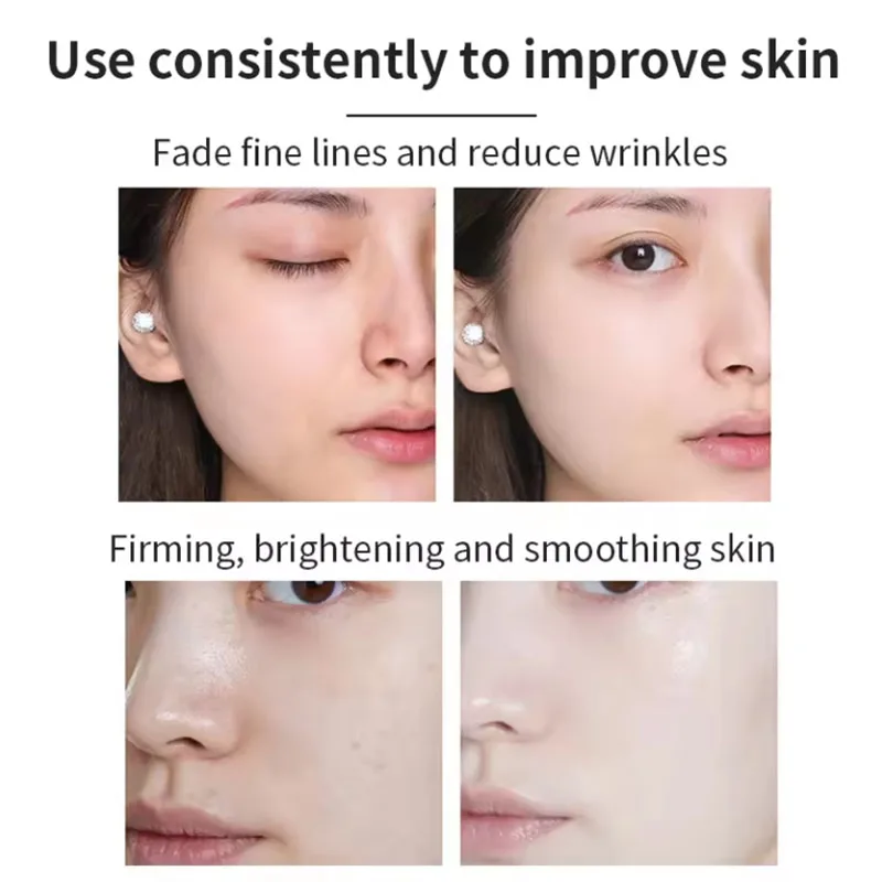 Private Label Whitening Remove Spots Remove Acne Caviar Peptide Protein Freeze-dried Powder Egf Microneedling Serum Kit