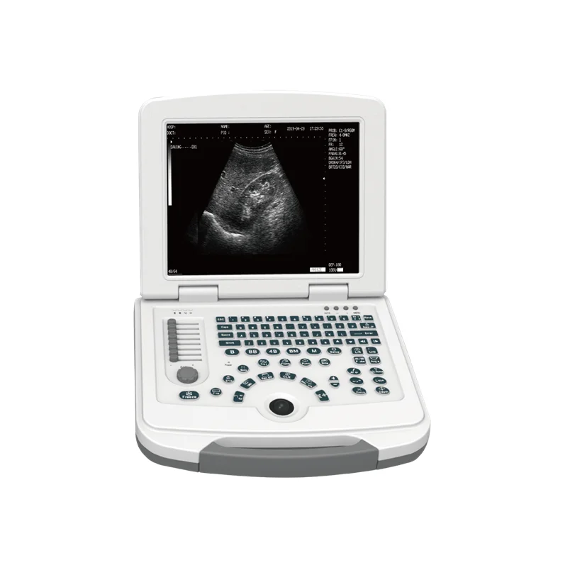 Factory Price Laptop B/W Medical Ultrasound Portable Instruments Convex Probe with Certificates