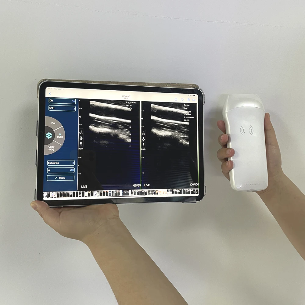 Other Ultrasonic & Electronic Equipment Portable Ultrasound Wireless Linear Probe Scanner 7.5/10mhz