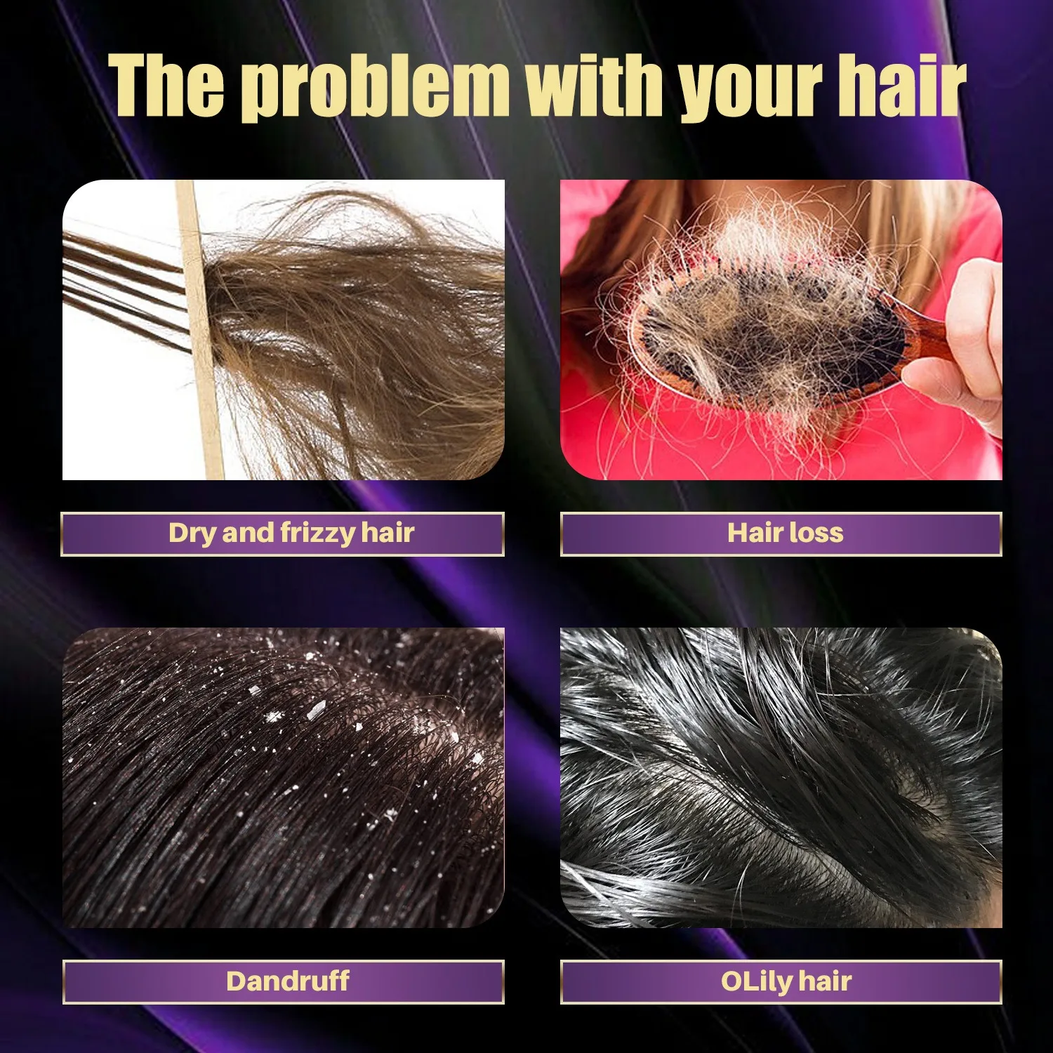 Factory Direct Organic Rosemary Onion Shampoo Refreshing Anti-Dandruff and Antipruritic Haircare Oil Hair-Loss Prevention
