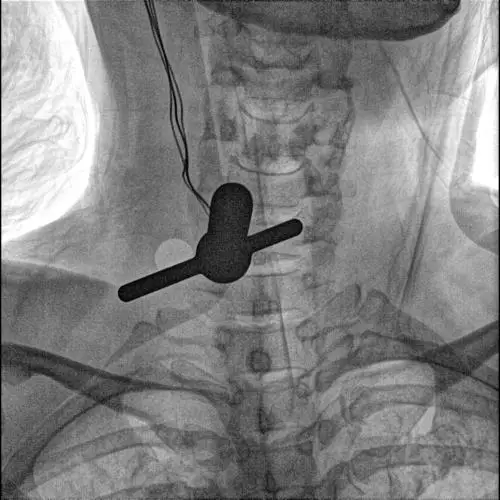 Advanced Mobile C arm x ray system with dual touch control