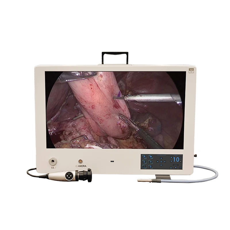 Integrated All in one Telepack Camera System for Arthroscopic Surgeries