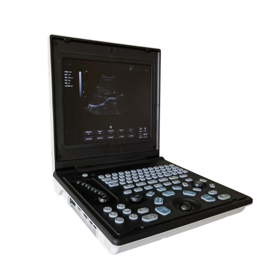 High Performance Portable Colour Full Digital CE ISO Approved Medical Diagnostic 3d Ultrasound Machine