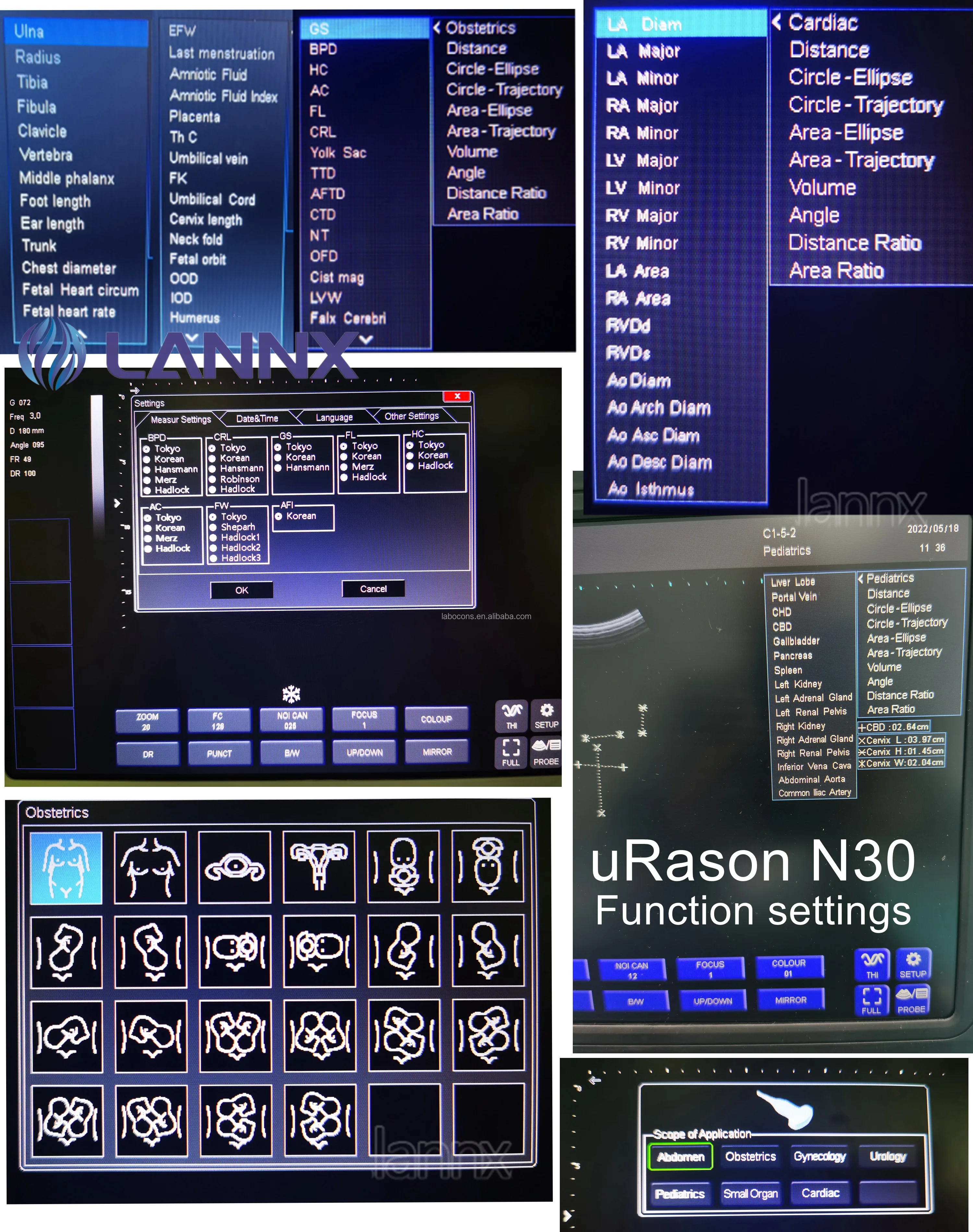 LANNX uRason N30 Cheapest Portable Color PW Ultrasound Echo Machine Diagnostic Ultrasound System for Clinic B/W Laptop USG