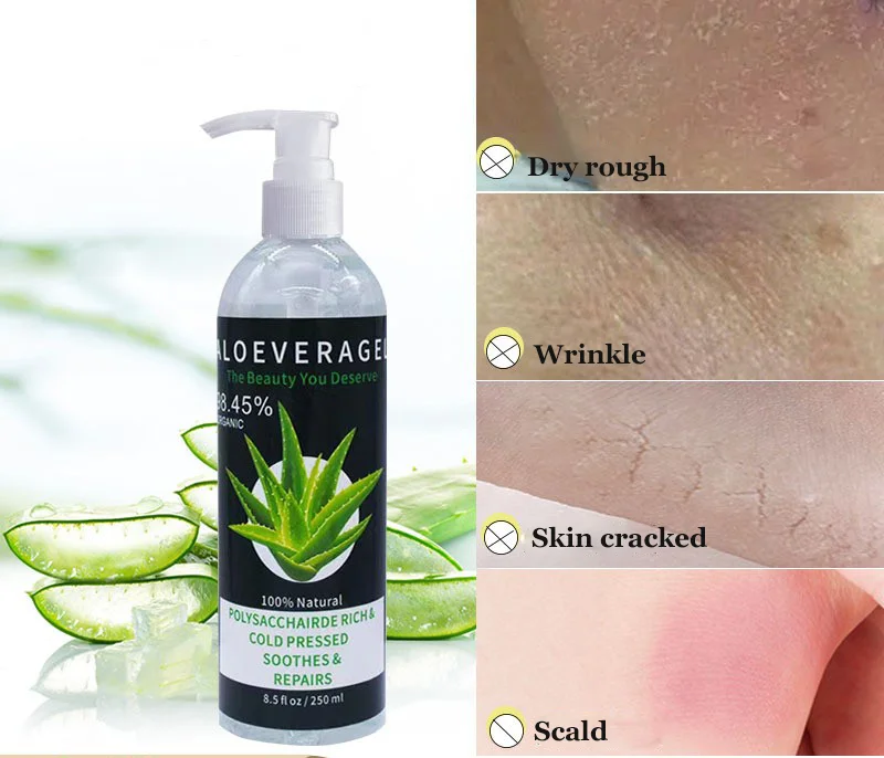 Organic 100% Pure Aloe Vera Gel Private Label Skin Repairing Smoothing Gel Aloe Vera Face Moisturizer For Face Care