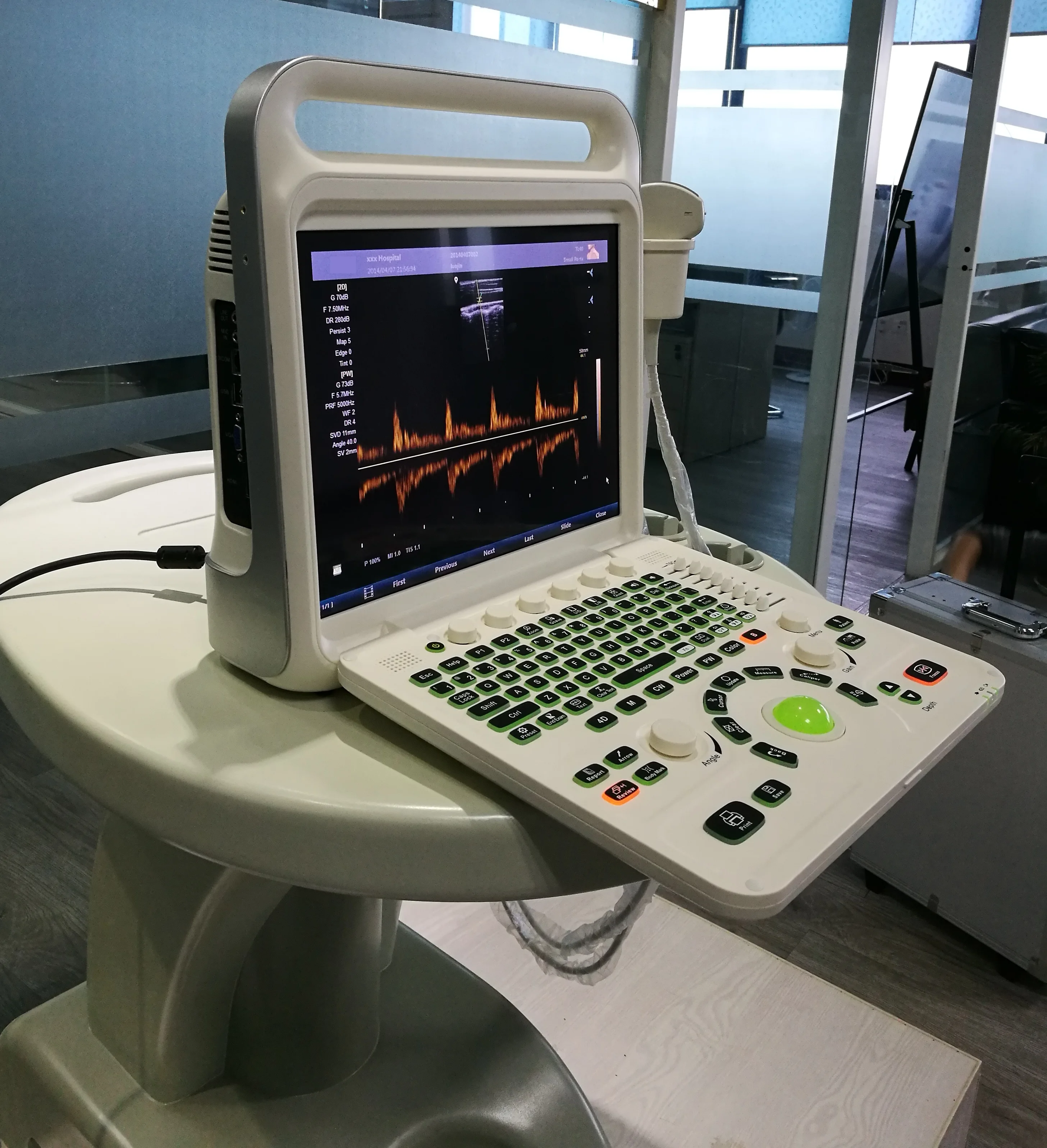 MHz 4D volumetric Portable notebook Color Doppler double probes ultrasound machine with 15 inches LCD monitor E60