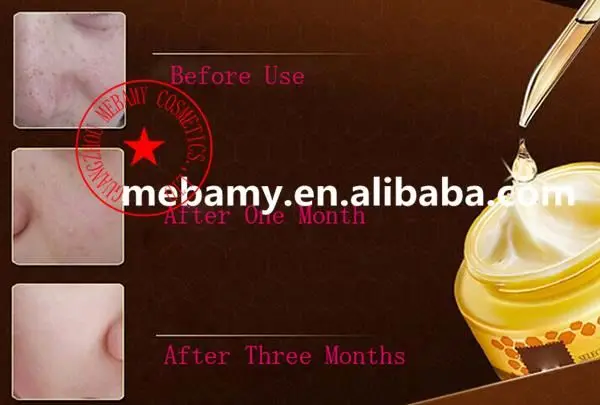 OEM/ODM Anti-aging Amino Acid Honey Bee Venom Whitening Facial Mask