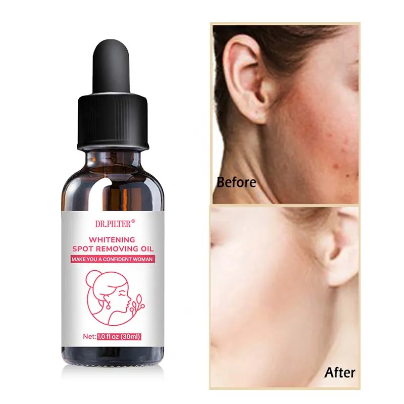 OEM/ODM Organic Whitening Body Facial Skin Care Anti-aging Brightening Anti-Wrinkle Repair Essential Oil Freckle-Removing