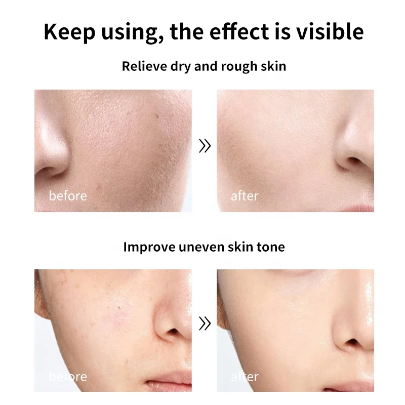 Natural Organic Pink Rose Mud Mask Facial Purifying Anti-Acne Anti-Toxin Whitening Moisturizing Pink Clay Mud Face Mask