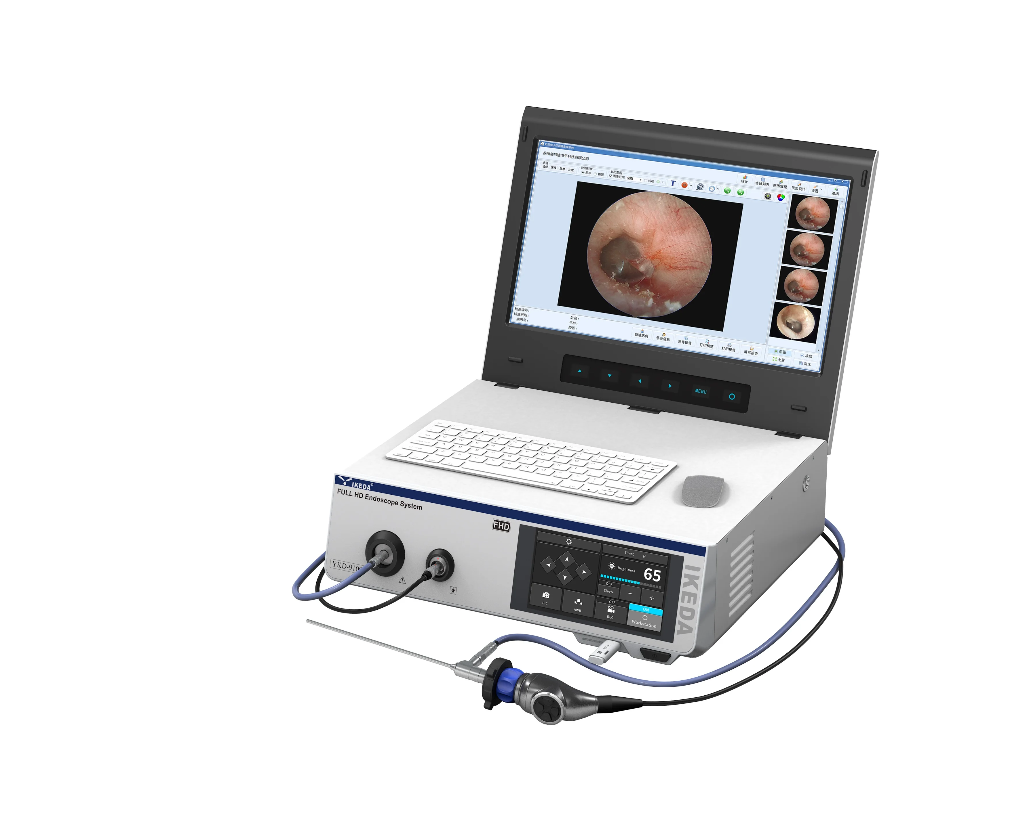 YKD-9100 medical endoscopy laparoscopic camera system for laparoscopy hysteroscopy