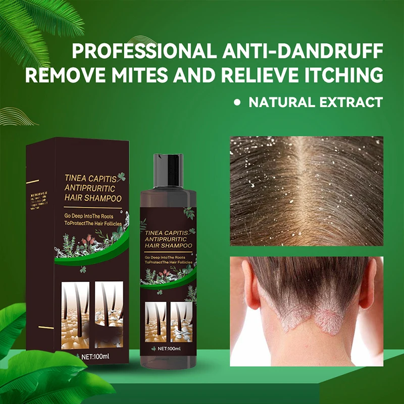 Shampoo Gentle Cleansing Smoothing Moisturizing Scalp Cleansing Refreshing Fragrance Conditioning Shampoo