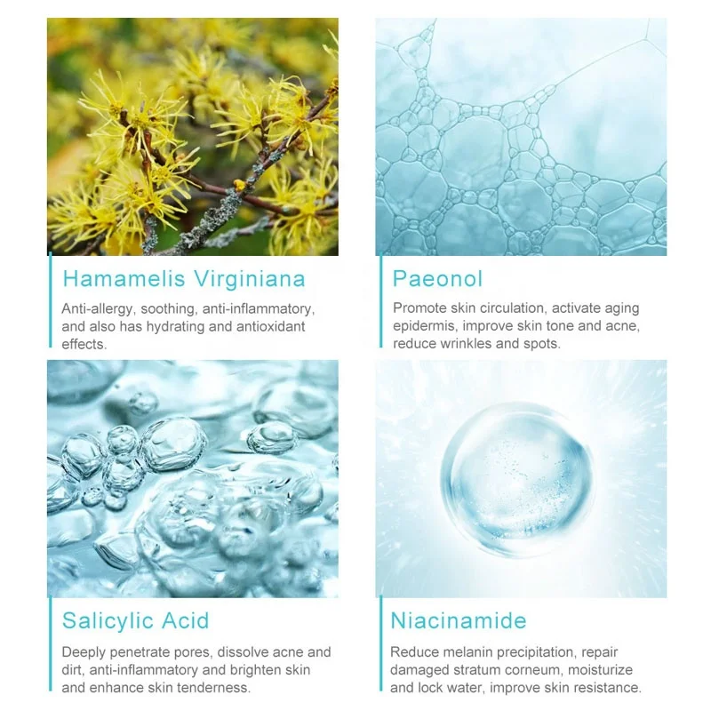 30g Acne Removal Freckle Cream Shrink Pores Whitening Moisturizing Oil Control Acne Cream Skin Care Treatment Face Cream