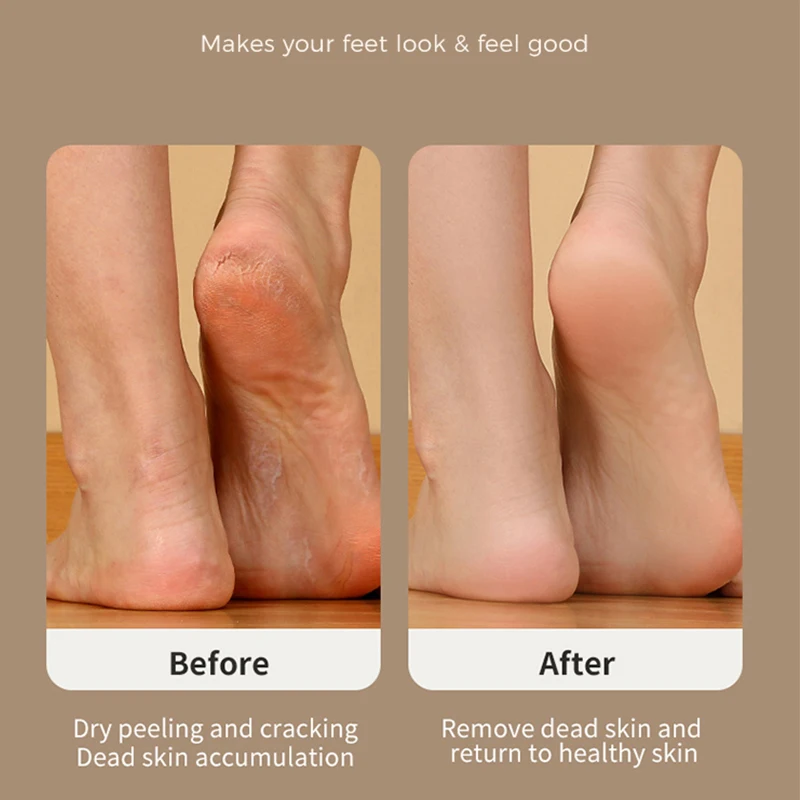 Electric Callus Remover Machine Feet Removes Calluses And Foot Grinder 3 in 1 Electric Pedicure Foot Callus Gel Remover