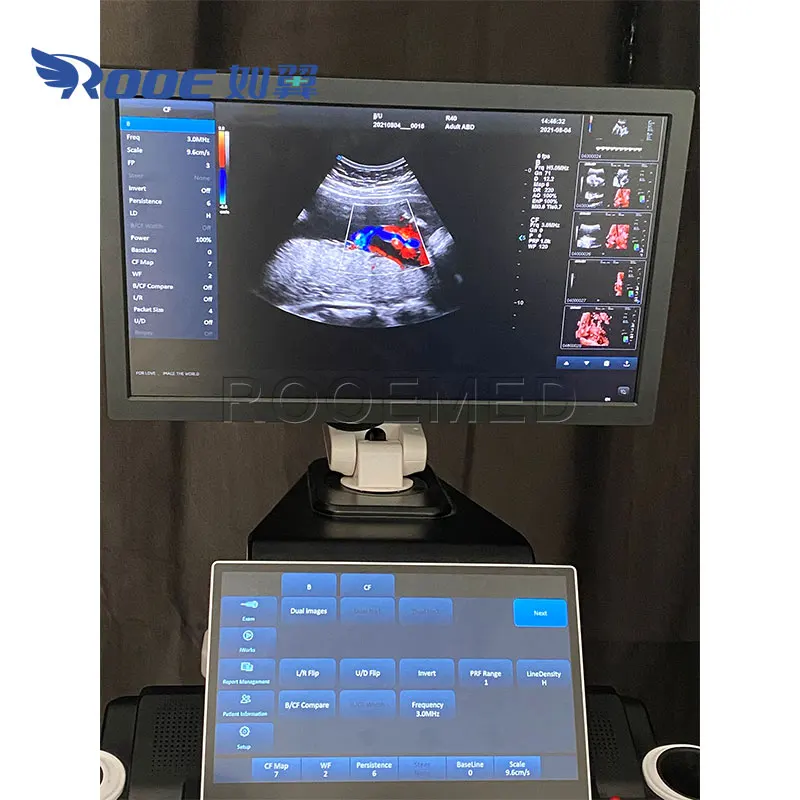 USC80 Pro Medical Imaging 4D RealSkin 5D Color Doppler Trolley for Ultrasound Machine