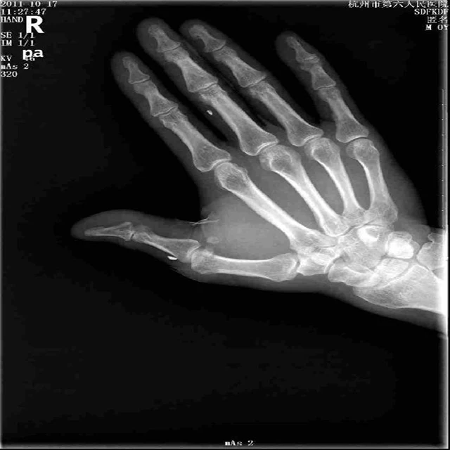 14x17 kenid x ray film / fuji film x ray di hl 14x17