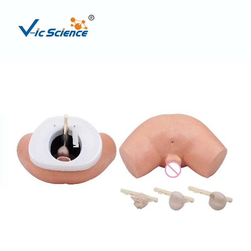 Four Interchangeable Prostates Examination Simulator Basing on Different Degrees of Prostate Carcinoma