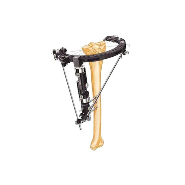 
Hot Sale Black Stainless Steel Elbow Joint External Fixator 