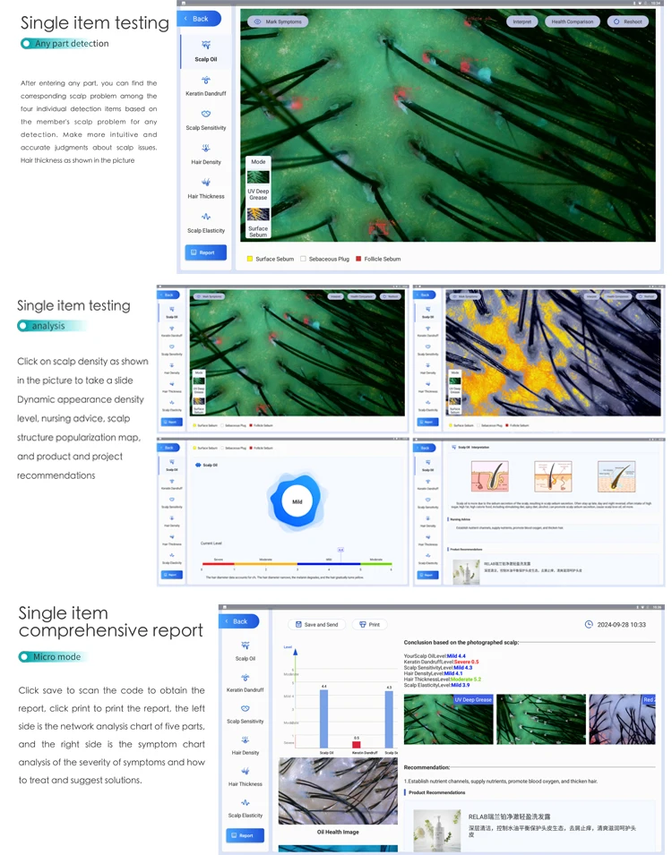 New Hair Scalp Scanner Energizer  Hair Growth Therapy Machine  Head Scalp Massage Scalp Analysis Hair Analysis Machine