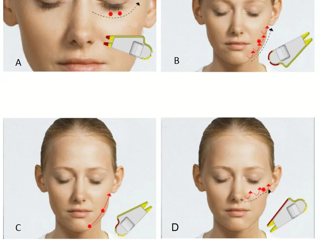 2024 New EMS Microcurrent Eyes Care Dark Circles Remove Machine Eye Massager Anti-wrinkle for Removing Dark Circle  Machine