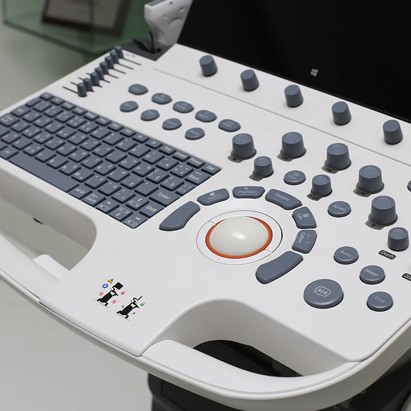 Sonoscape P40 Ultrasound Instruments 4d Full Digital Trolley Color Doppler Ultrasound Machine for Medical