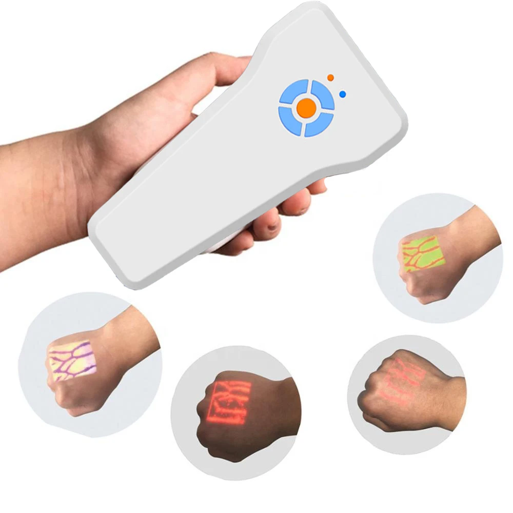 
Vein finder detects veins by infrared technology displaying vein map directly on skin 