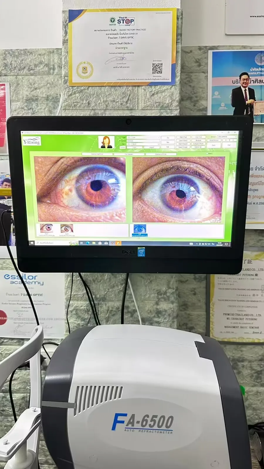 Portable Digital Analyzer Automatic Focus Test System Iridology Camera Eye Iriscope Health Care