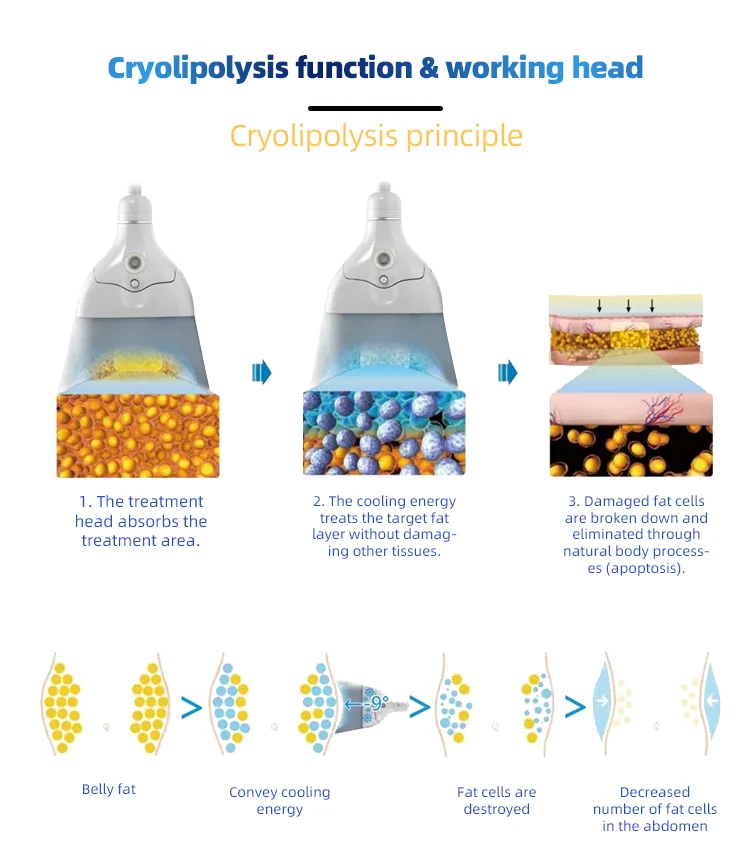 Best sale 2 handles body sculpt machine fat freezing machine cryolipolysis silicont vacuum cryolipolysis  machine