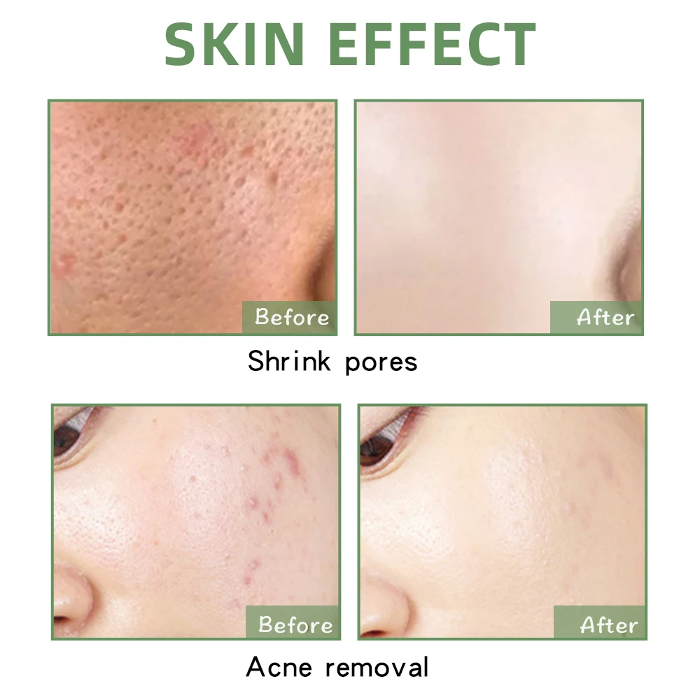 Best Selling Organic Face & Body Mask Whitening Rose Turmeric Charcoal Green Tea Face Mud Clay Mask