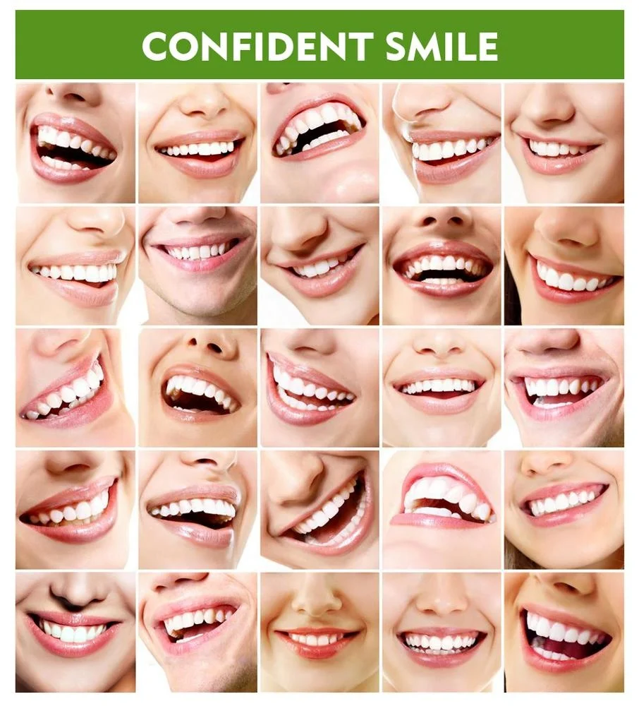 VIBRANT GLAMOUR Teeth Whitening Pen Cleaning Serum Remove Plaque Stains Protect Oral Hygiene Nursing