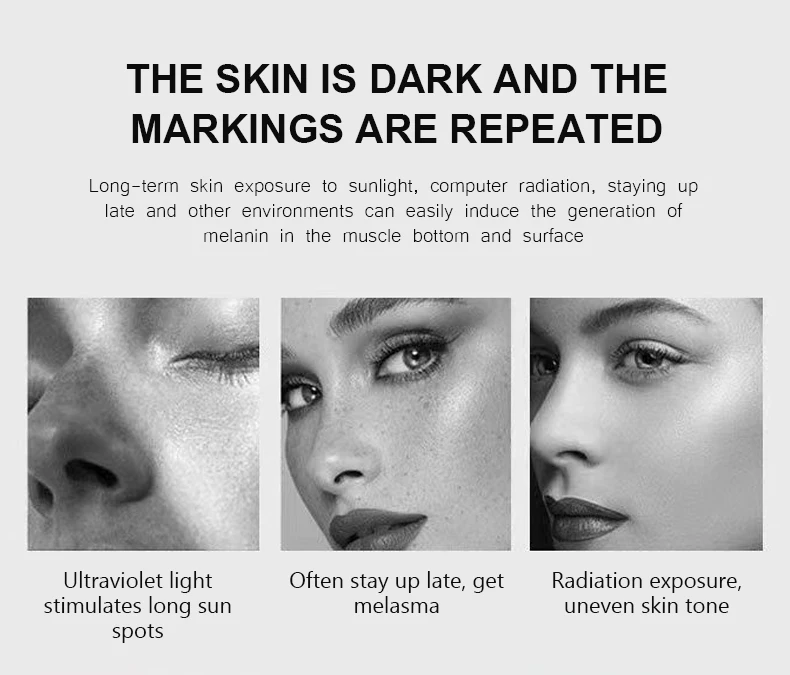 private label skin care cream niacinamide trehalose moisturizing brightening light spot repair skin cream